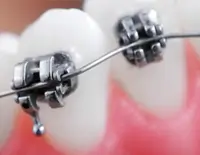 about-orthodontics-mega