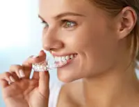 invisalign-costs-mega