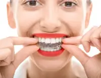invisalign-info-mega