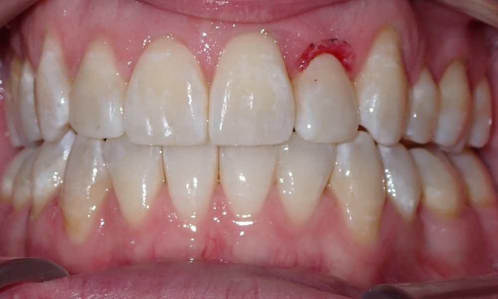 Justin-Crawford-Center-Intra-Oral-final