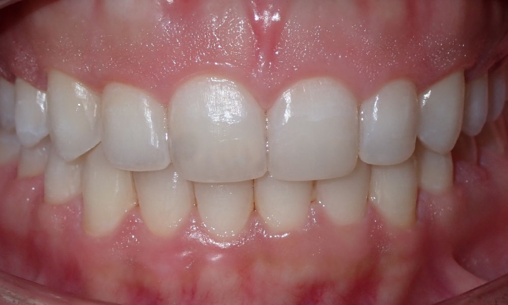 Shirin-Setayesh-Center-Intra-Oral-FINAL