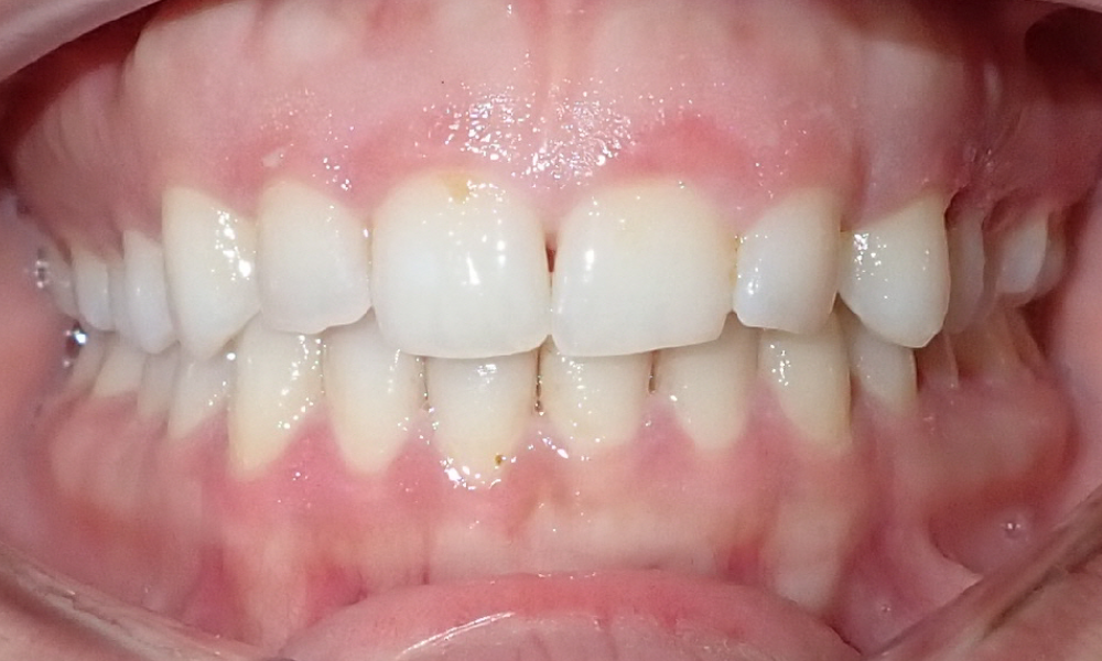 Shirin-Setayesh-Center-Intra-Oral